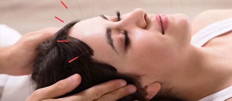 نوروپلاستیسیته در سکته مغزی چیست؟