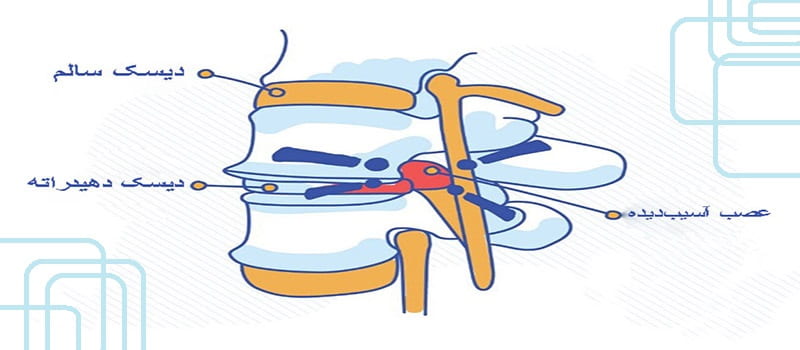 علائم دیسک سیاه