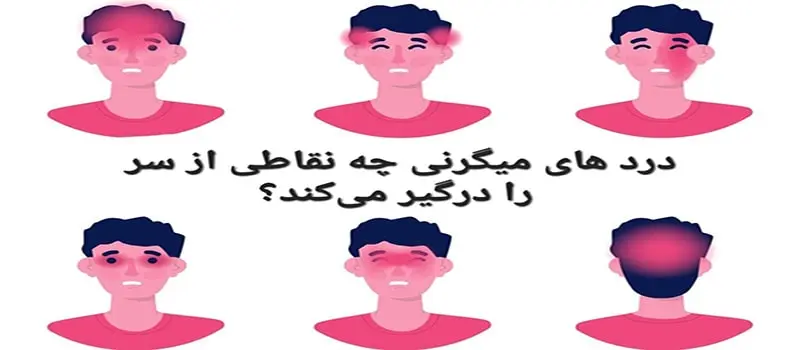 انواع سردردهای میگرنی