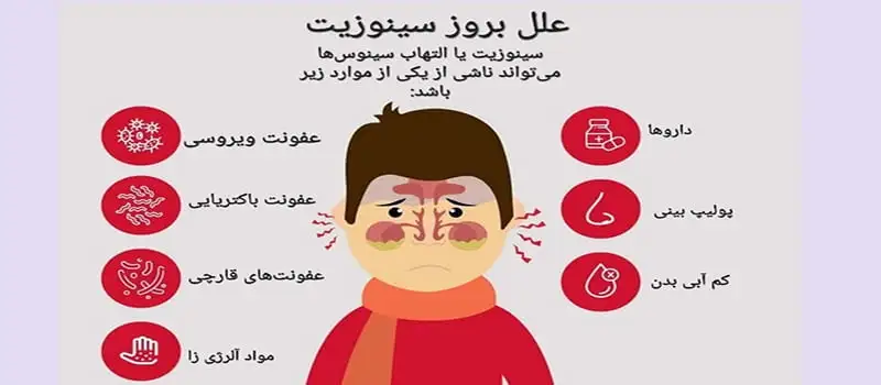 دلایل ایجاد سینوزیت