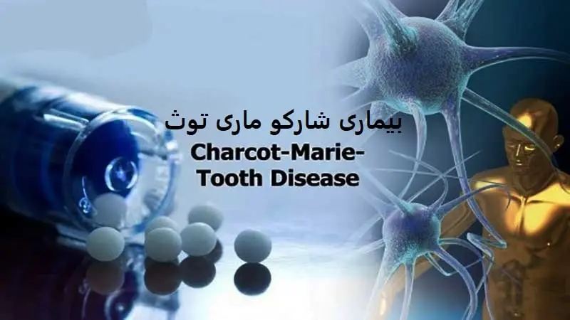 بیماری شارکو ماری توث