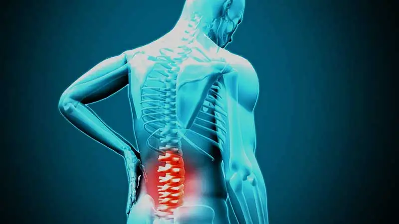 انواع دیسک ستون فقرات