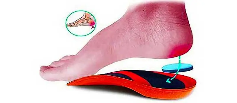 بازتوانی و تجویز کفی مناسب جهت خار پاشنه